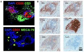 31, 1985 isaac camacho negron hearing feb. Frontiers Tertiary Lymphoid Organs In Cancer Immunology Mechanisms And The New Strategy For Immunotherapy Immunology