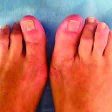 Tattoofilter is a tattoo community, tattoo gallery and international tattoo artist, studio and event directory. Pdf Medical Tattooing The New Frontiers A Case Of Nail Bed Treatment