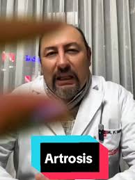 En este video, el Dr. Fernando Murillo, traumatólogo y ortopedista, nos  cuenta qué medidas podemos tomar para evitar sufrir de artrosis. 🦴💪 La  artrosis es una enfermedad degenerativa de las ...