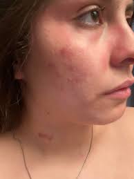 Cecred product usage order?