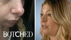 Jennifer Wants Her Jurassic Schnoz Fixed | Botched | E! - YouTube