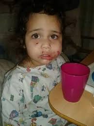 Toddler savaged by crazed dog in Birmingham park