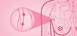 Common breast cancer symptoms, when they occur, include the following: What Is Inflammatory Breast Cancer And Why Should You Be Aware Of The Symptoms Breast Surgery Breast Oncology
