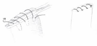 An oblique incision provides more direct exposure to the uterus. Surgery Suture Patterns Overview From Vetlexicon Definitive Veterinary Intelligence