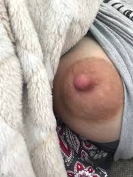 Extremely Puffy Nipple | MOTHERLESS.COM ™