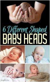 6 Different Shaped Baby Heads Baby Head Shape Baby Head Baby Development