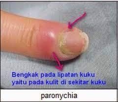 Pin Di Obat Herbal Ace Maxs