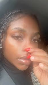 GA BADDIE🔥🔥🔥❤️❤️ , Thanks Queen. , -under-eye (tear trough) filler,  -chin/prejowl filler , -piriform fossa filler (nasolabial fold) , For  booking/more information send us a Dan, 📲Call/Whatsapp ...