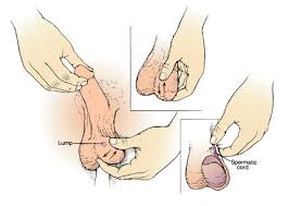 You may feel small, squishy lumps of tubes. Testicular Lump The British Association Of Urological Surgeons Limited