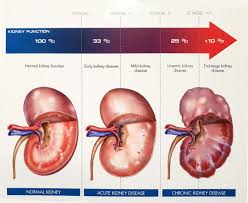 The communication presents current diagnostic methods in chronic renal failure (crf), outlines principles of its treatment. Chronic Kidney Disease In Pets Teva Veterinary Clinic