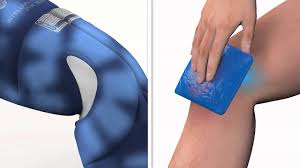 Always inspect the skin region covered by the polar care kodiak by lifting as instructed by the physician at least every 1 or 2 hours. Polar Care Kodiak Breg Inc