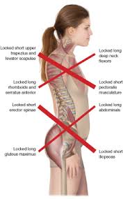 Thoracic Hyperkyphosis Critical Component Of Upper Crossed Syndrome