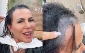 Corte químico e alopecia: médica explica problema capilar de Gretchen após  cantora perder fios - ISTOÉ Independente