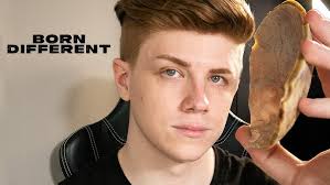 Born Without Hands And Feet