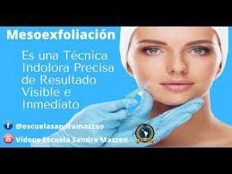 Sandra Mazzeo Piel sensible con cuperosis