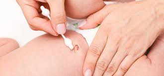 What to do after the umbilical cord falls off. Will Your Baby Have An Innie Or An Outie New Parent