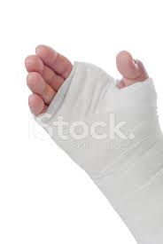 Dokum Bir Adamin Sag Eli Gosteren Sisme Ve Renk Degisikligi Stok Fotograflari Freeimages Com