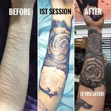 Women who go flat may also get tattoos. Get 42 Self Harm Tattoo Cover Up Reddit Formal Long Dress
