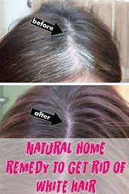 How To Get Rid Of Grey Hair At Home Grey Hair Remedies Hair Remedies White Hair Beauty