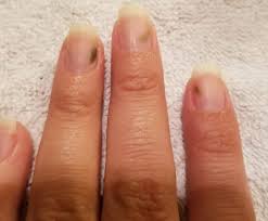 Picture within the past month or so i noticed what looks like streaks/spots of blood in the cuticles on my right hand. What Are These Green Spots On My Nails Diybeautyathome