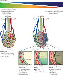 The Covid 19 Puzzle Deciphering Pathophysiology And Phenotypes Of A New Disease Entity The Lancet Respiratory Medicine
