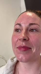 💦Hydro Facial Treatment💦, with the amazing James , Intro offer £60, This  amazing treatment is a 6 step process that detoxifies, rejuvenates,  hydrates and protects the skin 💫 , DM to book, #skincare ...