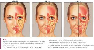 Sculptra aesthetic before and after image gallery. Sculptra Dr Monica Scheel Dermatology Kailua Kona Hi