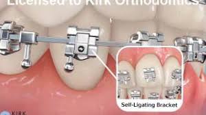 We did not find results for: Videos Kirk Orthodontics Carleton Place