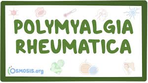 Image result for Polymyalgia Rheumatica