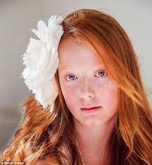 Artist Spreads Anti Bullying Message By Capturing Beauty Of Redheads Redheads Red Hair Woman Red Hair Freckles