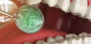 Image result for dental cancer