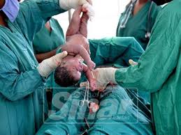 Namun, prosedur ini juga bukannya salah satu risiko melahirkan secara caesar adalah infeksi pada luka operasi. April Bulan Kesedaran Caesarean Sedunia
