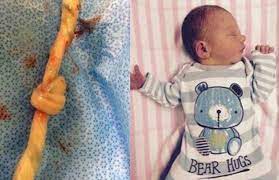 Birth Story My Baby S Laziness Saved His Life