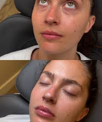 Andrea Gower (@andrea.injects) • Instagram photos and videos