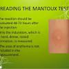 The tb skin test, also known as the mantoux tuberculin skin test, is the most common way doctors diagnose tuberculosis. Https Encrypted Tbn0 Gstatic Com Images Q Tbn And9gcqnidpijjiggcbf74snugheioogaqv4 Yc Fp0zpq1i9thej1s Usqp Cau