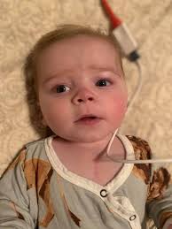 Gary's Recovery from Heart Surgery