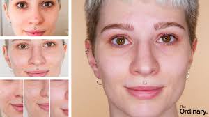 Buy the newest the ordinary niacinamide with the latest sales & promotions ★ find cheap offers ★ browse our wide selection of products. The Ordinary Review Before And After 31 Days 31 Pictures Youtube