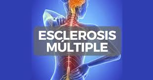 Cuántas personas tienen esclerosis múltiple: Conoce La Esclerosis Multiple Centro Edace