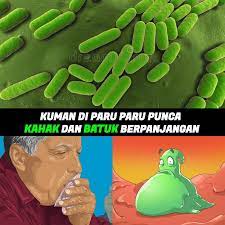Kenali punca batuk batuk kenali puncanya # jangkitan virus (menyebabkan batuk berpanjangan selama beberapa minggu selepas selesema) # spasma (pengecutan tidak terkawal). Ariff Healthcare Jika Batuk Berterusan Hampir 3 Minggu Itu Adalah Tanda Paru Paru Telah Dijangkiti Kuman Simptom Seperti Batuk Dan Kahak Berpanjangan Sesak Nafas Semput Demam Dan Hidung Tersumbat Info