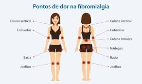 Fibromyalgia is currently understood to be a disorder of central pain processing or a syndrome of central sensitivity. Tratamento Da Fibromialgia Com Bomba De Infusao