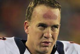 Is it possible to get back to a normal life when you are at that point? Peyton Manning S Helmet Mark Gets Its Own Tv Show Forehead Of The Class The Heckler