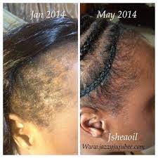 Pin By Junette Mirlande On J Shea Essential Oil Relaxed Hair Muscle Relaxer Itchy Scalp