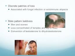 A variety of conditions can cause permanent or temporary hair loss, including hormonal changes due to pregnancy, childbirth, menopause and thyroid problems. Thyroid Disease And Hair Loss Types Of Hair Loss Generalized Shedding More Hair In Drains On Brush No Specific Patches Of Loss Or Baldness Most Common Ppt Download