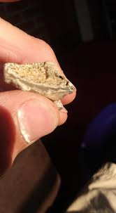 What kind of tooth is this?