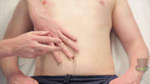 Assessment Of The Spleen - Youtube