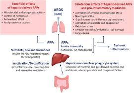What does ards look like? Liver Lung Interactions In Acute Respiratory Distress Syndrome Intensive Care Medicine Experimental Full Text