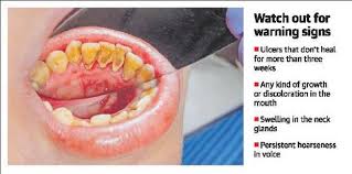 Mouth cancer, also known as oral cancer is cancer where a tumor occurs in any part of the mouth; Be On Your Guard There S Cancer Lurking In Your Mouth The Hindu