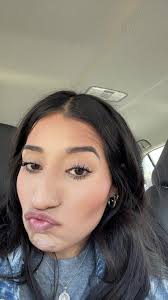 Braces Color Change and Bracket Adjustment Experience