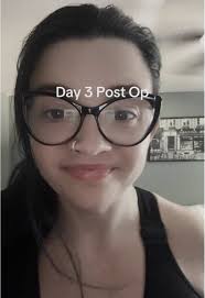 Peeled Lesion Off Rib Muscle Fascia Post Surgery Pain