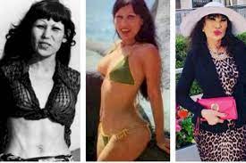 Lyn may en noches de cabaret (1978). Vedette Lyn May Luce Nuevo Rostro Despues De Su Quinta Cirugia Plastica En Un Nuevo Dia Mexico Nchs La Republica